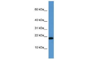 Image no. 1 for anti-SH2 Domain Containing 1A (SH2D1A) (C-Term) antibody (ABIN2788421)