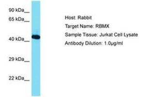 Image no. 1 for anti-RNA Binding Motif Protein, X-Linked (RBMX) (AA 210-259) antibody (ABIN6750464)
