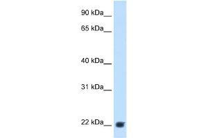 Image no. 1 for anti-Kallikrein B, Plasma (Fletcher Factor) 1 (KLKB1) (Middle Region) antibody (ABIN2782312)