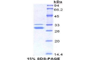 Image no. 1 for High Mobility Group Box 1 (HMGB1) (AA 1-215) protein (His tag) (ABIN1079868)