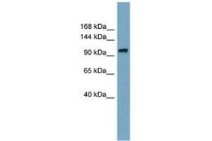 Image no. 1 for anti-Elongator Acetyltransferase Complex Subunit 2 (ELP2) (AA 323-372) antibody (ABIN6744138)