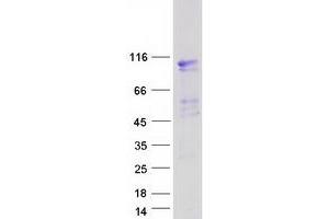 EVI5L Protein (Myc-DYKDDDDK Tag)