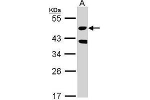 Image no. 2 for anti-serine/threonine Kinase 24 (STK24) (Internal Region), (Thr178) antibody (ABIN2856894)