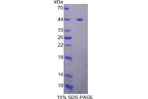 Image no. 1 for Zinc Finger Protein GLI1 (GLI1) (AA 810-1109) protein (His tag) (ABIN6238202)