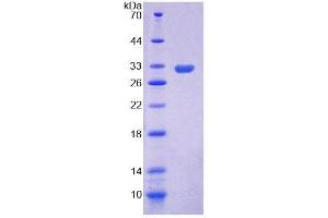 Image no. 1 for Mitogen-Activated Protein Kinase Kinase Kinase 5 (MAP3K5) (AA 681-936) protein (His tag) (ABIN6240009)