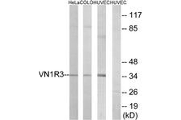 Vomeronasal 1 Receptor 3 (VMN1R3) (AA 129-178) antibody