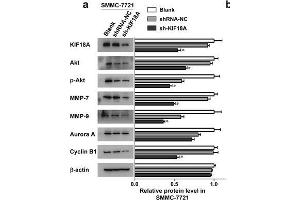 The expression of KIF18A and other signal pathway-related proteins in hepatoma cells.