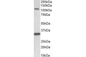 Image no. 2 for anti-Mast/stem Cell Growth Factor Receptor (KIT) (Internal Region) antibody (ABIN1589992)