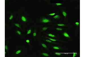 Immunofluorescence of purified MaxPab antibody to NEK3 on HeLa cell.
