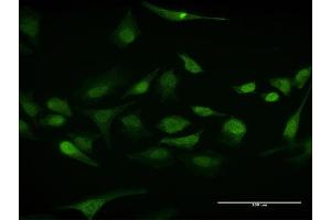 Image no. 2 for anti-ELAV (Embryonic Lethal, Abnormal Vision, Drosophila)-Like 1 (Hu Antigen R) (ELAVL1) (AA 1-326) antibody (ABIN947826)