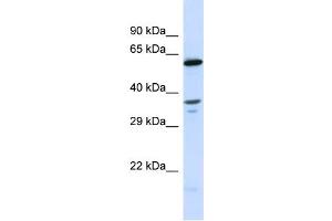 Image no. 1 for anti-UDP-N-Acetyl-alpha-D-Galactosamine:polypeptide N-Acetylgalactosaminyltransferase 10 (GalNAc-T10) (GALNT10) (C-Term) antibody (ABIN2783508)