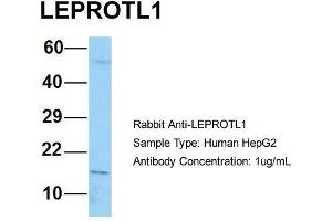 Image no. 2 for anti-Leptin Receptor Overlapping Transcript-Like 1 (LEPROTL1) (N-Term) antibody (ABIN2790809)