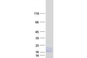 Image no. 1 for Ribosomal Protein L14 (RPL14) (Transcript Variant 1) protein (Myc-DYKDDDDK Tag) (ABIN2731129)