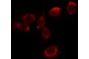 Image no. 2 for anti-Hemoglobin Alpha 1 + 2 (HBA1,HBA2) (Internal Region) antibody (ABIN6262153)