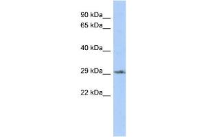 Image no. 1 for anti-Distal-Less Homeobox Protein 1 (DLX1) (N-Term) antibody (ABIN2778572)