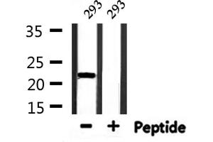 Image no. 4 for anti-TEA Domain Family Member 1 (SV40 Transcriptional Enhancer Factor) (TEAD1) antibody (ABIN6257778)