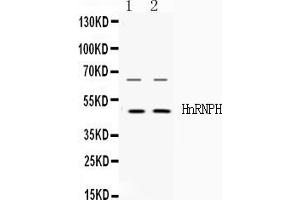 Image no. 1 for anti-Heterogeneous Nuclear Ribonucleoprotein H1 (H) (HNRNPH1) (AA 23-52), (N-Term) antibody (ABIN4886623)