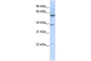 Image no. 1 for anti-Solute Carrier Family 35, Member F3 (SLC35F3) antibody (ABIN2458816)