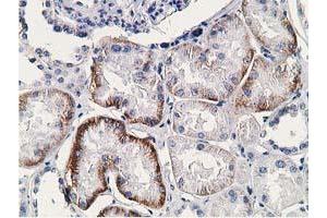 Image no. 7 for anti-Synovial Sarcoma, X Breakpoint 1 (SSX1) antibody (ABIN1501156)