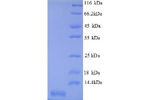 Image no. 1 for Chemokine (C-X-C Motif) Ligand 3 (CXCL3) (AA 32-100) protein (His tag) (ABIN5712666)