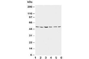 Image no. 6 for anti-Presenilin 2 (Alzheimer Disease 4) (PSEN2) (N-Term) antibody (ABIN3032302)