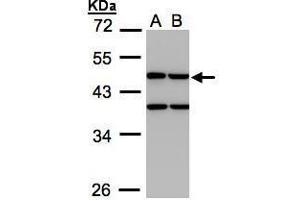 Image no. 2 for anti-Creatine Kinase, Mitochondrial 1B (CKMT1B) (Center) antibody (ABIN2855669)