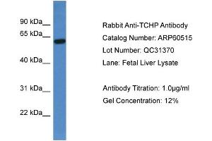 Image no. 2 for anti-Trichoplein, Keratin Filament Binding (TCHP) (C-Term) antibody (ABIN2788476)