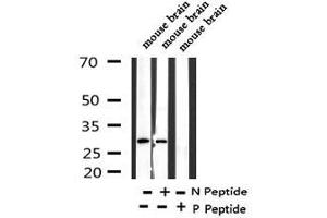 Image no. 1 for anti-Myristoylated Alanine-Rich Protein Kinase C Substrate (MARCKS) (pSer170) antibody (ABIN6269993)