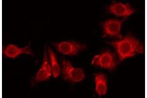 Image no. 1 for anti-Transmembrane Protein 101 (TMEM101) (Internal Region) antibody (ABIN6259494)