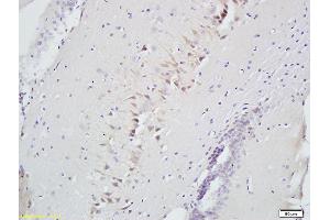 Image no. 2 for anti-CD160 (CD160) (AA 81-159) antibody (ABIN741555)
