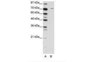 Image no. 1 for anti-Leucine Zipper, Putative Tumor Suppressor 1 (LZTS1) (C-Term) antibody (ABIN202796)