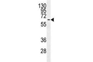 Image no. 3 for anti-Mitogen-Activated Protein Kinase 15 (MAPK15) antibody (ABIN3028844)