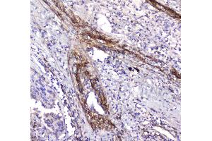 Image no. 3 for anti-Amyloid P Component, Serum (APCS) (AA 20-220) antibody (ABIN5693182)