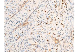 Image no. 6 for anti-Spleen tyrosine Kinase (SYK) (pTyr323) antibody (ABIN6256708)