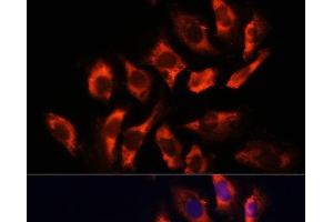 Immunofluorescence analysis of U-2 OS cells using RYR2 Polyclonal Antibody at dilution of 1:100 (40x lens).