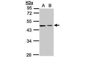WB Image Sample(30 ug whole cell lysate) A:A431, B:Hep G2 , 10% SDS PAGE antibody diluted at 1:1000