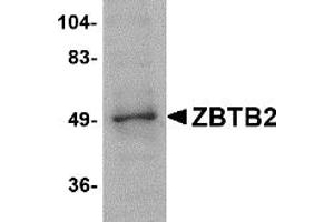 Image no. 1 for anti-Zinc Finger and BTB Domain Containing 2 (ZBTB2) (Middle Region) antibody (ABIN1031170)