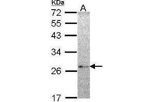 Image no. 1 for anti-NME/NM23 Family Member 5 (NME5) (Center) antibody (ABIN2855404)