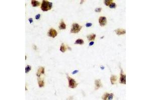 Image no. 2 for anti-Fragile X Mental Retardation 1 (FMR1) (full length) antibody (ABIN6005206)