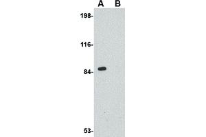 Image no. 3 for anti-Regulating Synaptic Membrane Exocytosis 2 (RIMS2) (Internal Region) antibody (ABIN6656362)
