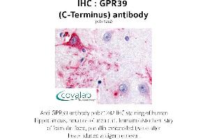 Image no. 1 for anti-G Protein-Coupled Receptor 39 (GPR39) (C-Term) antibody (ABIN1735081)