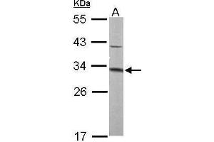 Image no. 5 for anti-Methylthioadenosine phosphorylase (MTAP) (full length) antibody (ABIN2856653)