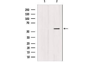 Image no. 2 for anti-Forkhead Box C1 (FOXC1) antibody (ABIN6256860)