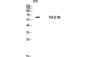 Image no. 2 for anti-Transforming Growth Factor, beta Receptor II (70/80kDa) (TGFBR2) (Tyr159) antibody (ABIN3187247)