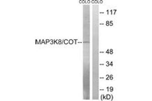Image no. 1 for anti-Mitogen-Activated Protein Kinase Kinase Kinase 8 (MAP3K8) (AA 366-415) antibody (ABIN1533088)