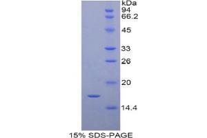 Image no. 1 for Retinol Binding Protein 7, Cellular (RBP7) protein (ABIN3011495)