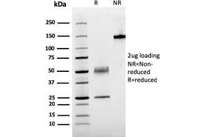 Image no. 1 for anti-Parathyroid Hormone (PTH) (AA 1-34) antibody (ABIN6940427)