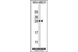 Image no. 1 for anti-Kallikrein 7 (KLK7) (AA 67-97) antibody (ABIN652197)