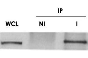 anti-Cytoskeleton Associated Protein 5 (CKAP5) antibody