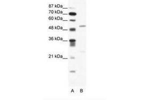 Image no. 1 for anti-Bromodomain Containing 9 (BRD9) (AA 145-194) antibody (ABIN203177)